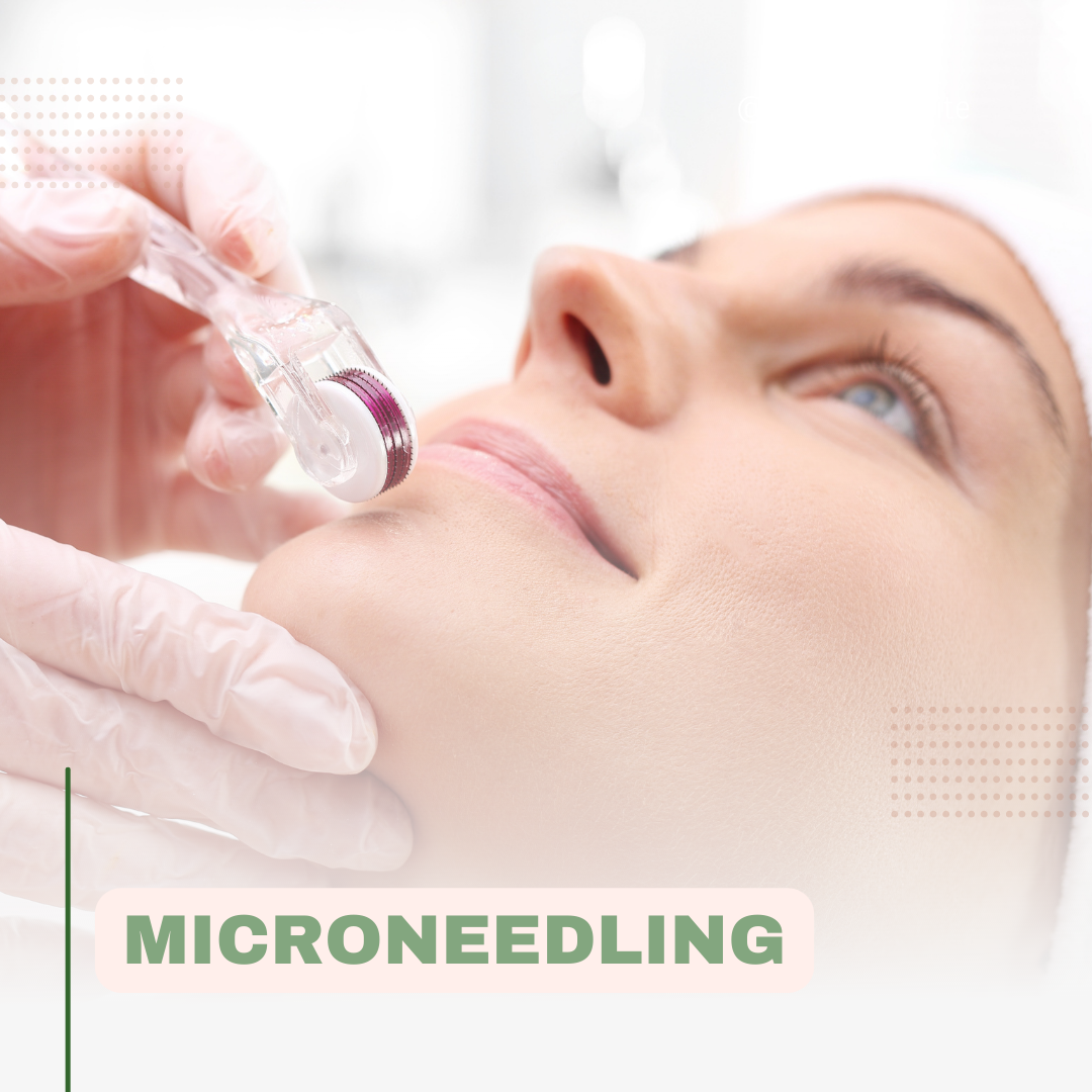 Microneedling Facial